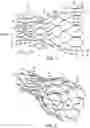 Fig. 02 - Stent structures for use with valve replacements