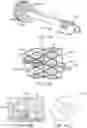 Fig. 12 - Tension member routing elements in transcatheter stented prosthesis tensioning system