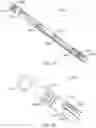 Fig. 17 - Tension member routing elements in transcatheter stented prosthesis tensioning system