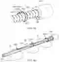 Fig. 24 - Tension member routing elements in transcatheter stented prosthesis tensioning system