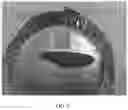 Fig. 03 - Compression resistant implants including an oxysterol and methods of use