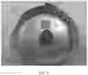 Fig. 04 - Compression resistant implants including an oxysterol and methods of use