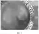 Fig. 06 - Compression resistant implants including an oxysterol and methods of use