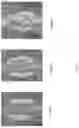 Fig. 07 - Compression resistant implants including an oxysterol and methods of use