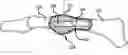 Fig. 01 - Poly-faced bone fusion implant