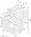 Fig. 02 - Rotatable intervertebral spacing implant