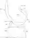 Fig. 01 - SYSTEMS AND METHODS FOR PROVIDING A FEMORAL COMPONENT