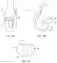 Fig. 03 - SYSTEMS AND METHODS FOR PROVIDING A FEMORAL COMPONENT