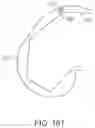 Fig. 43 - SYSTEMS AND METHODS FOR PROVIDING A FEMORAL COMPONENT