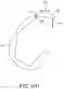 Fig. 44 - SYSTEMS AND METHODS FOR PROVIDING A FEMORAL COMPONENT