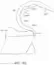 Fig. 49 - SYSTEMS AND METHODS FOR PROVIDING A FEMORAL COMPONENT
