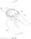 Fig. 67 - SYSTEMS AND METHODS FOR PROVIDING A FEMORAL COMPONENT