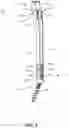 Fig. 05 - Spinal implant system and method