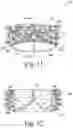 Fig. 11 - Device for endovascular aortic repair and method of using the same