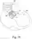 Fig. 16 - Device for endovascular aortic repair and method of using the same