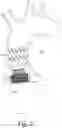 Fig. 20 - Device for endovascular aortic repair and method of using the same