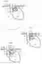 Fig. 02 - Methods and instruments for treating GERD and hiatal hernia
