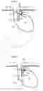 Fig. 03 - Methods and instruments for treating GERD and hiatal hernia