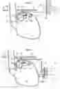 Fig. 05 - Methods and instruments for treating GERD and hiatal hernia
