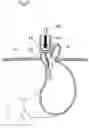 Fig. 20 - Methods and instruments for treating GERD and hiatal hernia