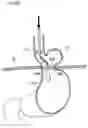 Fig. 22 - Methods and instruments for treating GERD and hiatal hernia