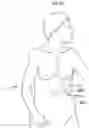 Fig. 37 - Methods and instruments for treating GERD and hiatal hernia