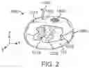 Fig. 07 - Methods and devices for deploying and releasing a temporary implant within the body