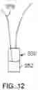 Fig. 22 - Methods and devices for deploying and releasing a temporary implant within the body