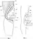 Fig. 06 - Functional knit orthopedic device