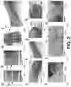 Fig. 04 - Smart thermal patch for adaptive thermotherapy