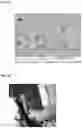 Fig. 07 - Hemostatic paste and methods of making thereof