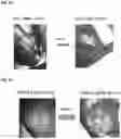 Fig. 09 - Hemostatic paste and methods of making thereof