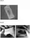 Fig. 12 - Hemostatic paste and methods of making thereof