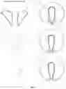 Fig. 06 - ADJUSTABLE ABSORBENT ARTICLE