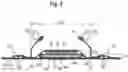 Fig. 03 - ABSORBENT ARTICLE COMPRISING ATTACHMENT REGION
