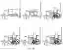 Fig. 22 - Mobility device securement system