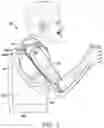 Fig. 02 - Upper torso wearable orthotic device with dynamic leveling system