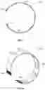 Fig. 02 - Device and Method for Treatment of Equine Neonatal Maladjustment Syndrome