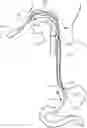 Fig. 01 - Acoustic reflectometry device in catheters