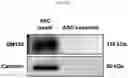 Fig. 05 - Lyophilized formulation of stem cell-derived exosomes and anti-inflammatory composition including the same as active ingredient