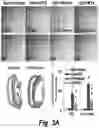 Fig. 07 - Methods for administration and methods for treating cardiovascular diseases with resiniferatoxin