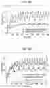 Fig. 06 - Dextromethorphan transdermal delivery device