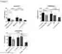 Fig. 07 - Method of Treating Focal Segmental Glomerulosclerosis