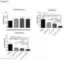Fig. 09 - Method of Treating Focal Segmental Glomerulosclerosis