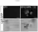 Fig. 13 - Compositions, systems, and methods for generating inner ear hair cells for treatment of hearing loss