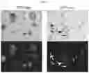 Fig. 22 - Compositions, systems, and methods for generating inner ear hair cells for treatment of hearing loss