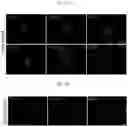 Fig. 24 - Compositions, systems, and methods for generating inner ear hair cells for treatment of hearing loss