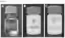 Fig. 07 - Compositions for treating spinal muscular atrophy