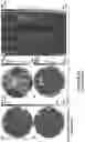 Fig. 25 - DETECTION OF METASTATIC DISEASE AND RELATED METHODS