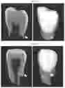 Fig. 06 - Compounds, Compositions, and Methods for Treating And/Or Preventing Periodontal Disease